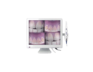 OFERTA CAMARA INTRAORAL M-958-A PANTALLA LCD 15 +